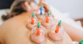 Dra. Francilene Paulino, Massagem Relaxante com Ventosas e Aromaterapia Dra. Francilene Paulino, Massagem Relaxante com Ventosas e Aromaterapia
